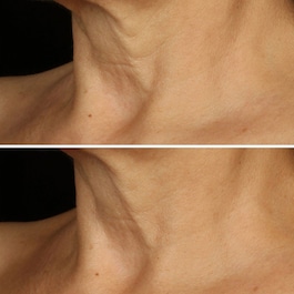 Smart Clinical Repair- Creme Lift Anti Rugas