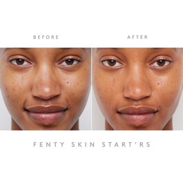 Start'r Set Revamp - Coffret Tratamento