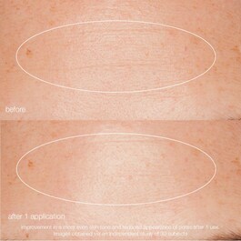 Liquid Peelfoliant - Esfoliante Facial