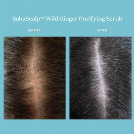 SahaScalp™ Gingembre Sauvage- Exfoliante Purificante