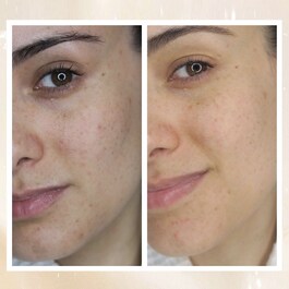 Radiance Overnight Glow Cream