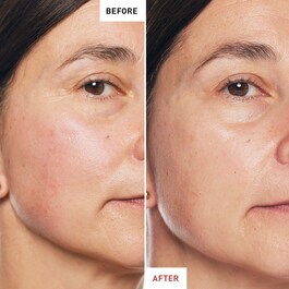 SKIN THERAPY - Óleo noturno multi-aperfeiçoador